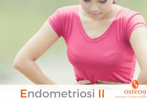 Endometriosi – Parte II