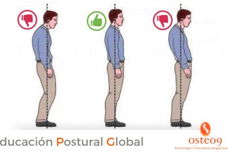 Cómo mejorar la postura con reeducación postural global